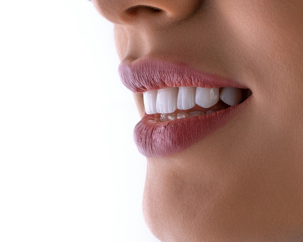 Fasete — Sano Dental & Aesthetic, Kragujevac