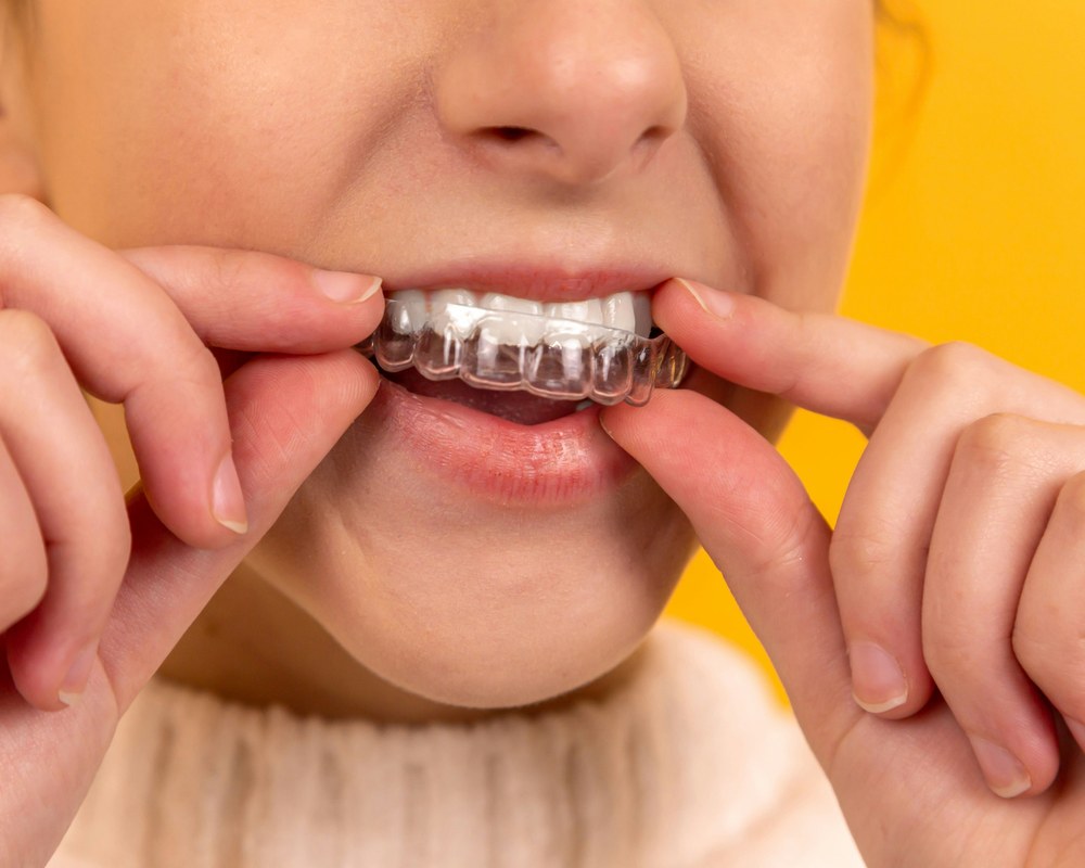 Ortodoncija — Sano Dental & Aesthetic, Kragujevac